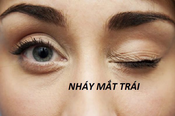 nháy mắt trái