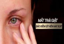Mắt trái giật nữ